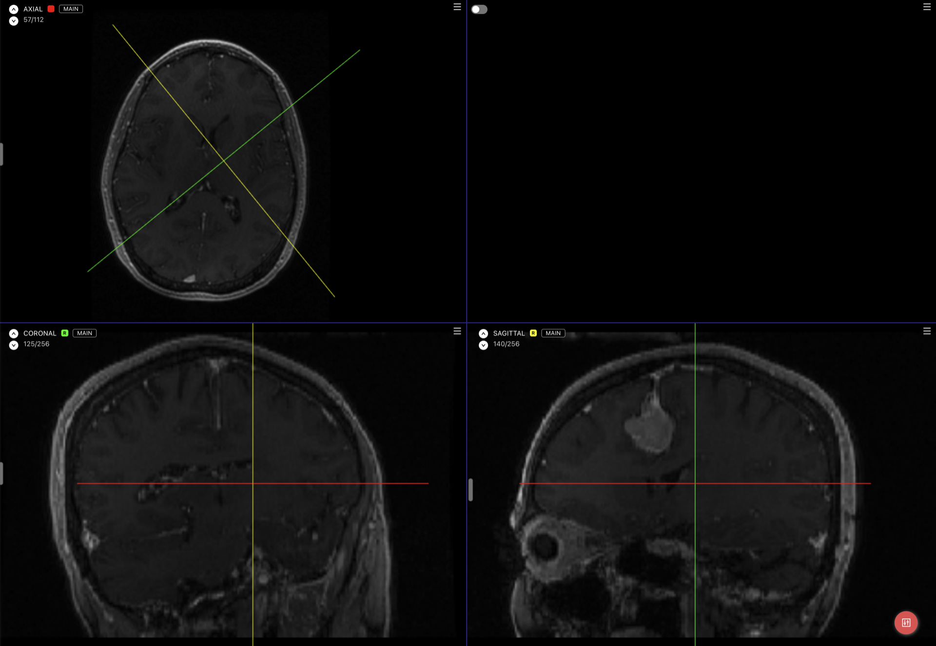 Reformatted medical views marked with R and showing perpendicular color-coded crosshairs