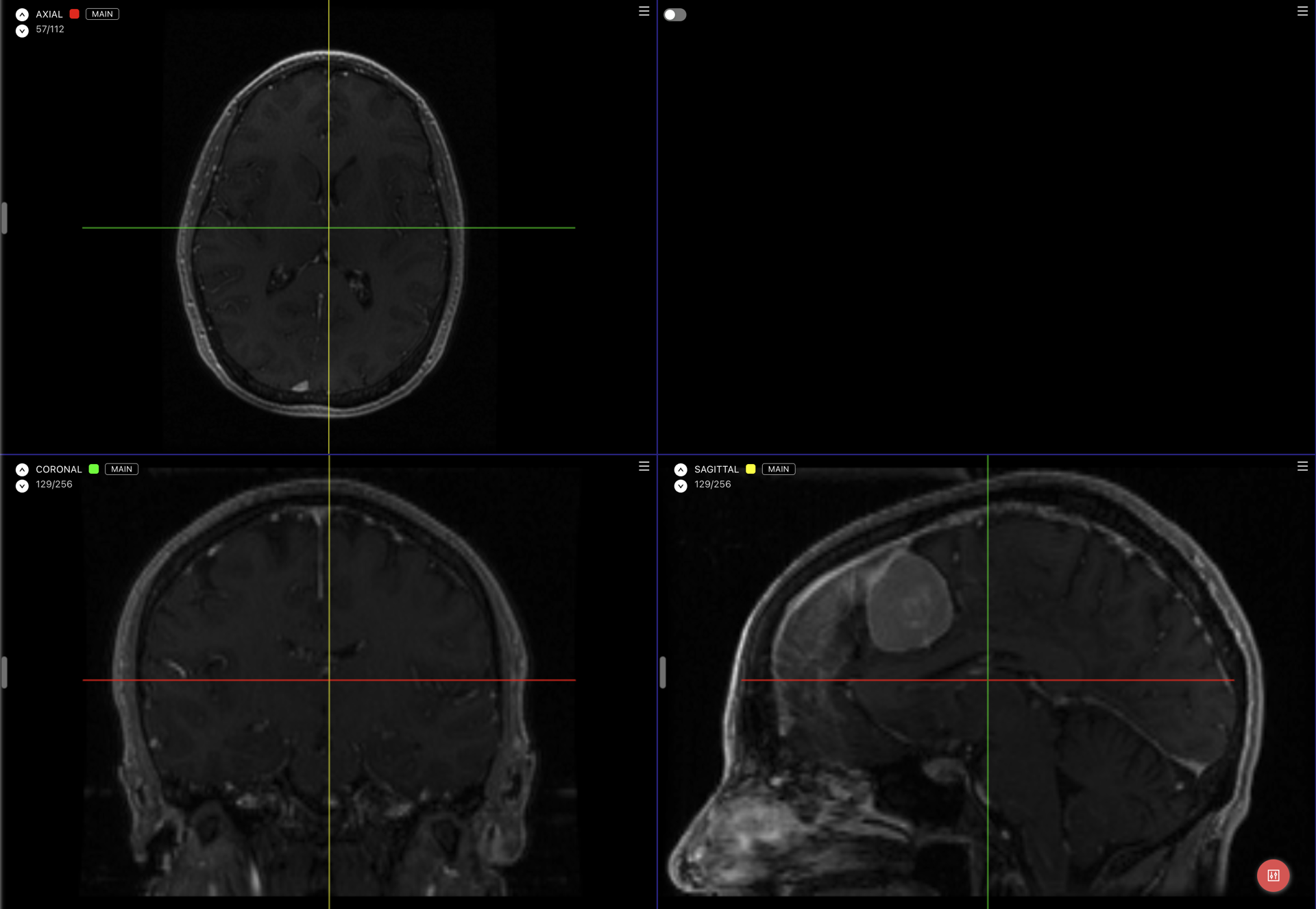 Axial, Coronal, and Sagittal views with color-coded crosshair lines