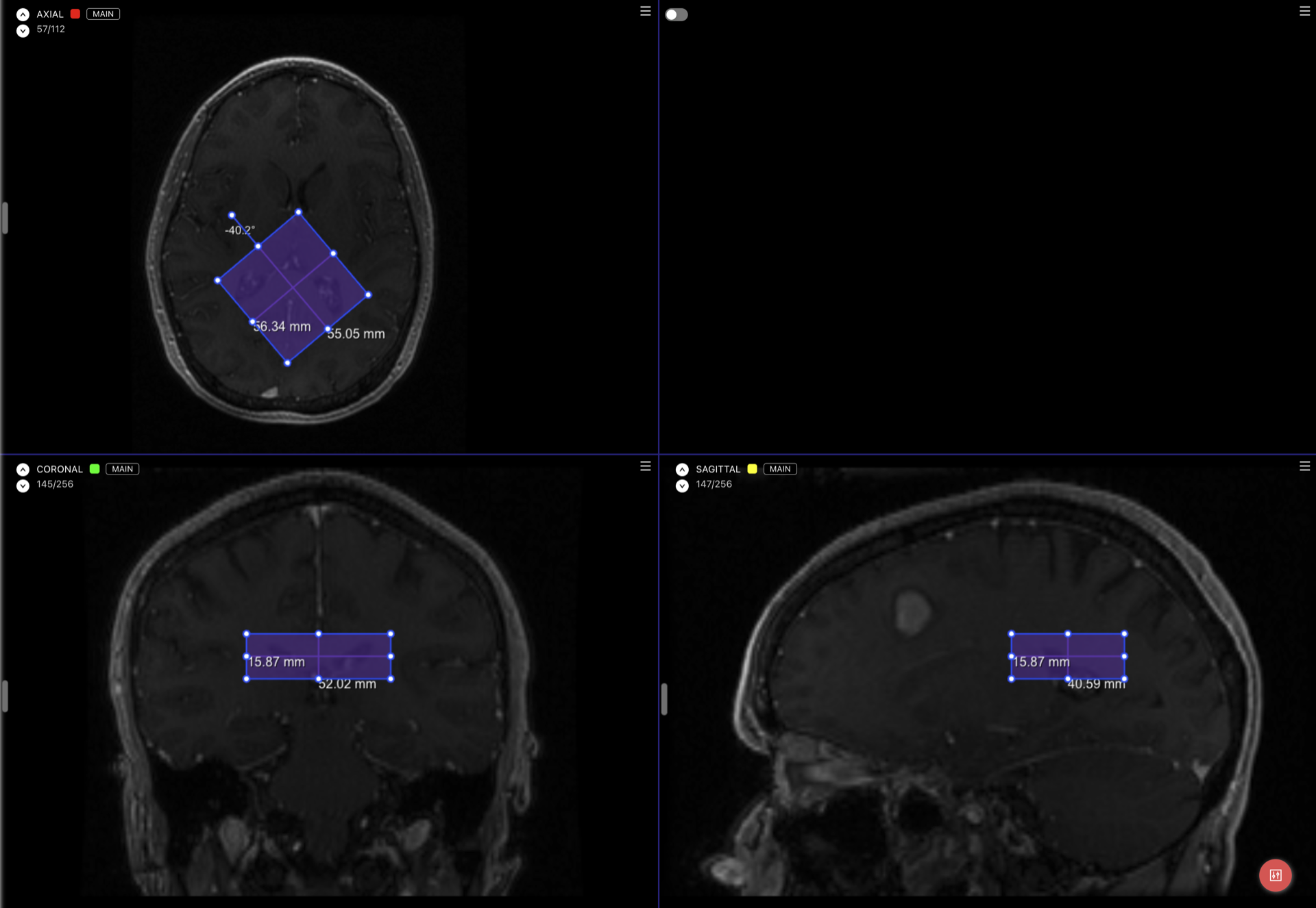 Rotated bounding box with physical measurements across the Axial, Coronal, and Sagittal views